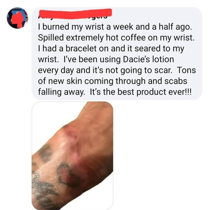 Lotion, 4oz